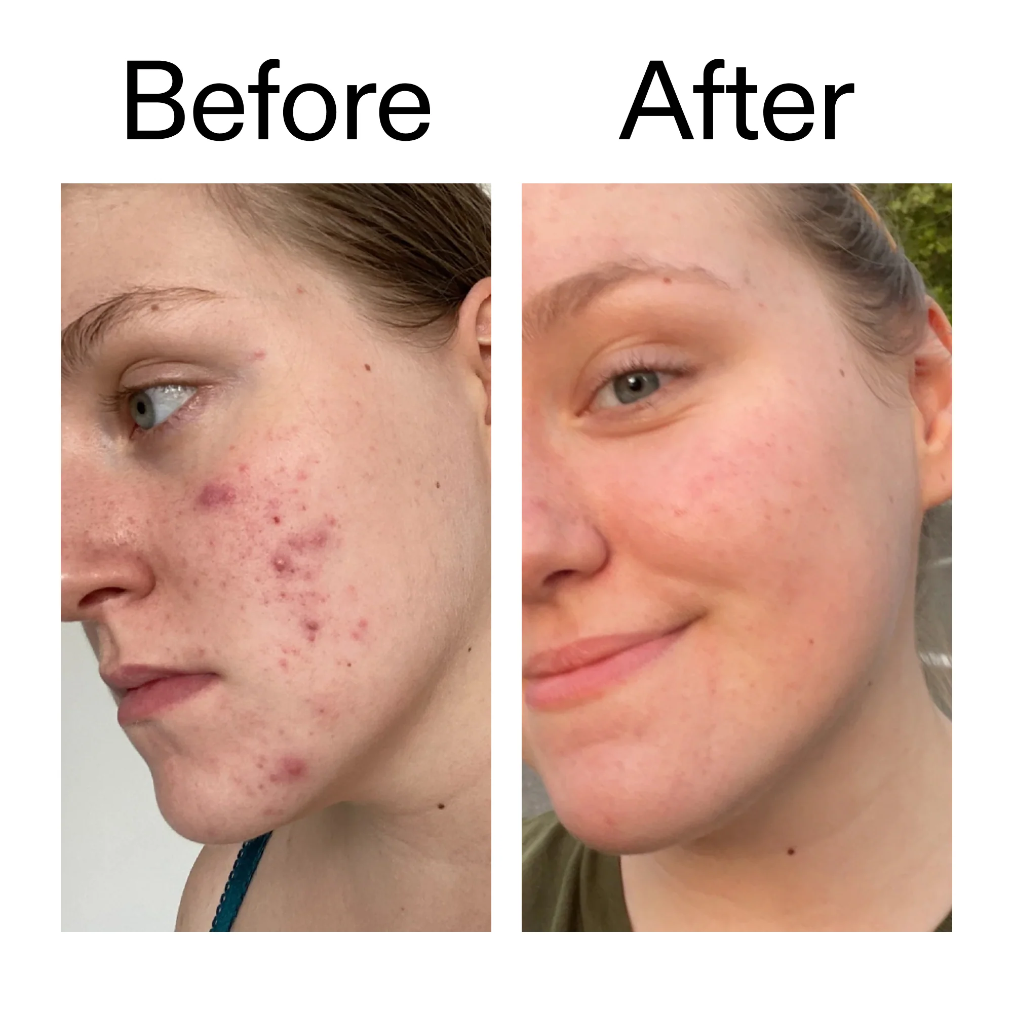 15% Vitamin C + EGF Serum - Image 10