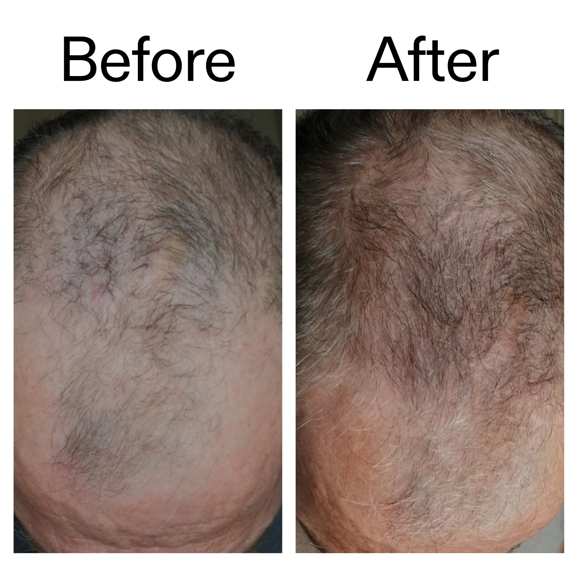 3 Month Hair Growth Trio - Image 7