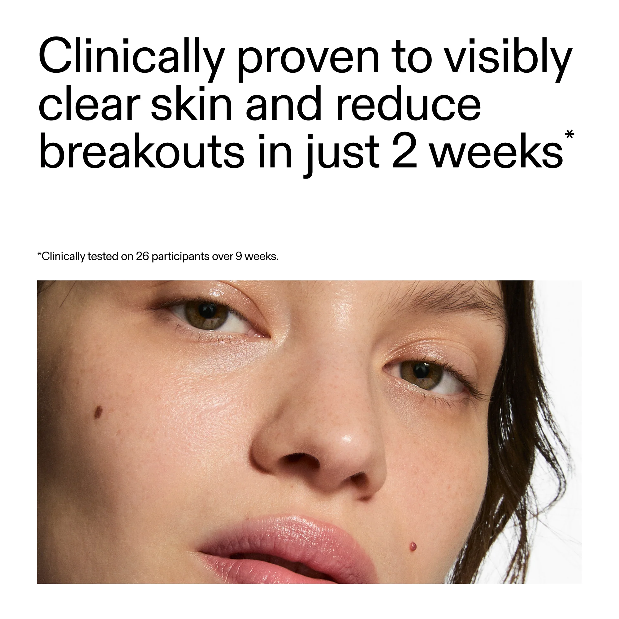 360° Acne Clearing Duo - Image 5