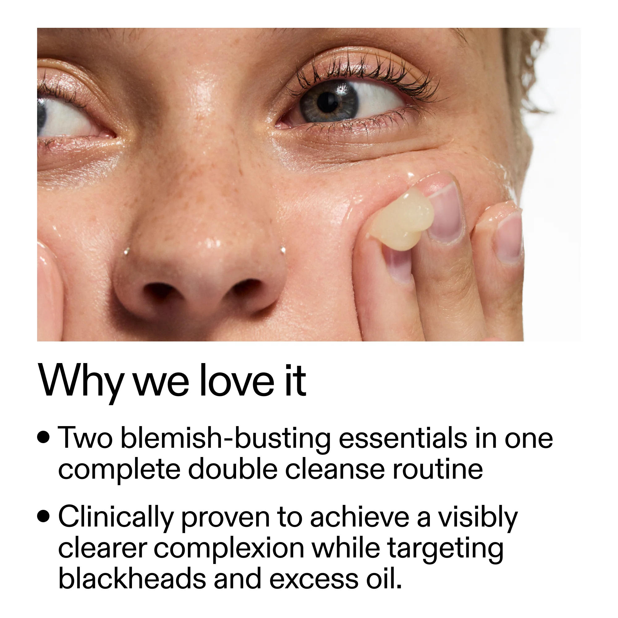 Acne Double Cleanse Duo - Image 4