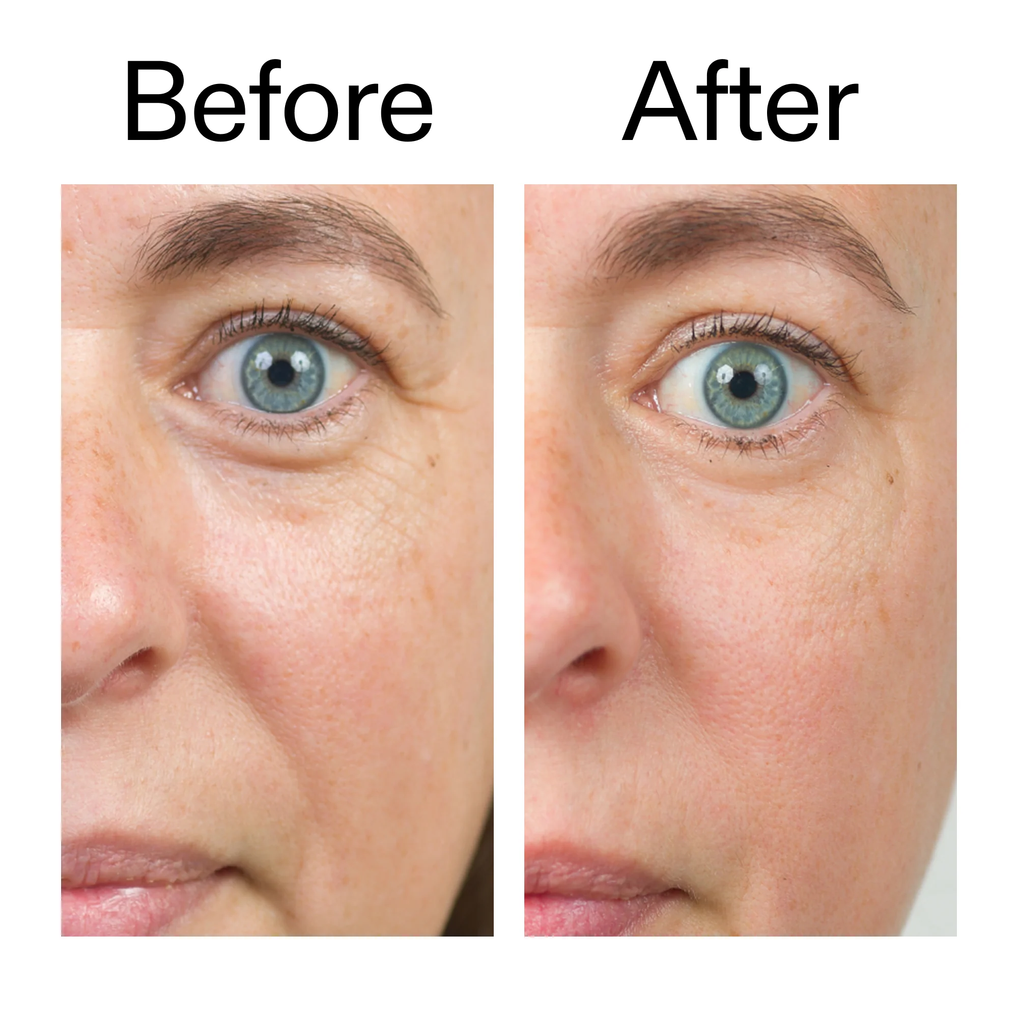 Bio-Active Ceramide Moisturizer - Image 10