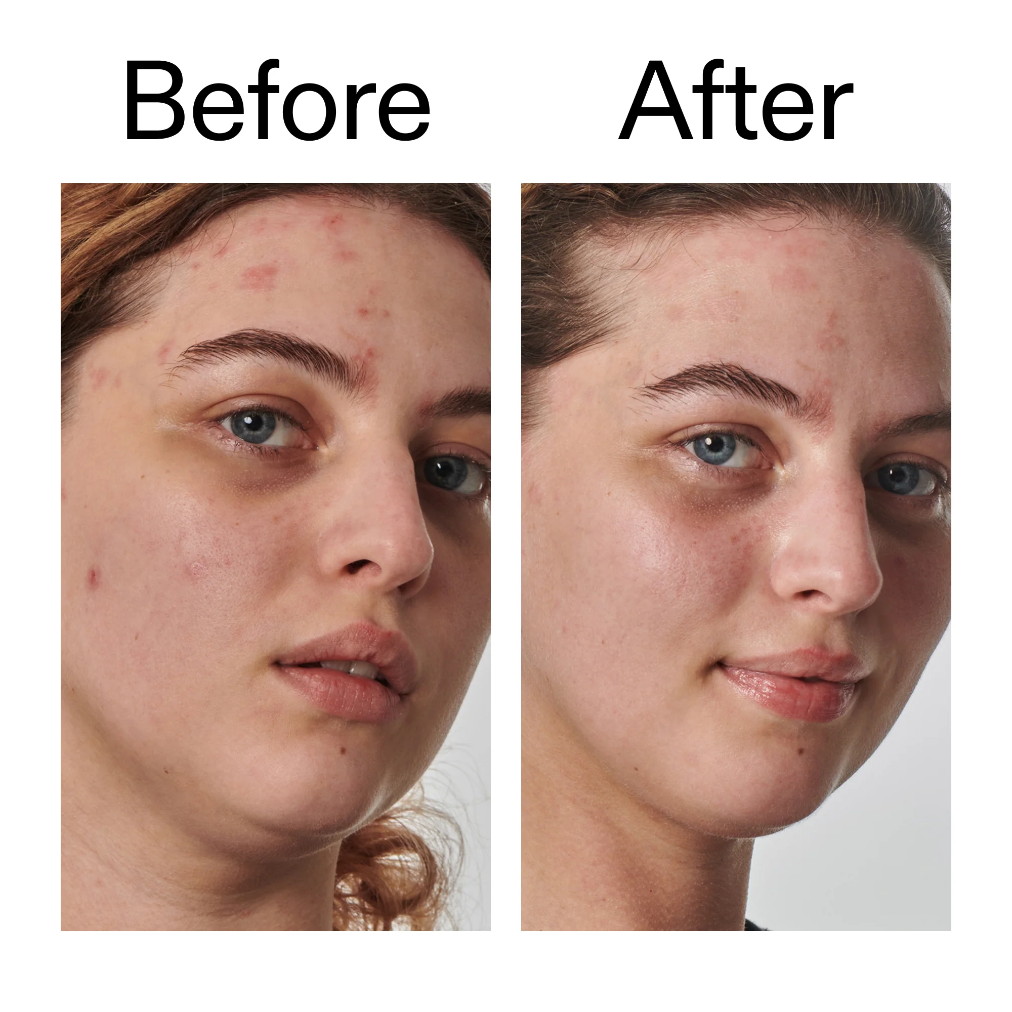 10% Urea Moisturizer - Image 10
