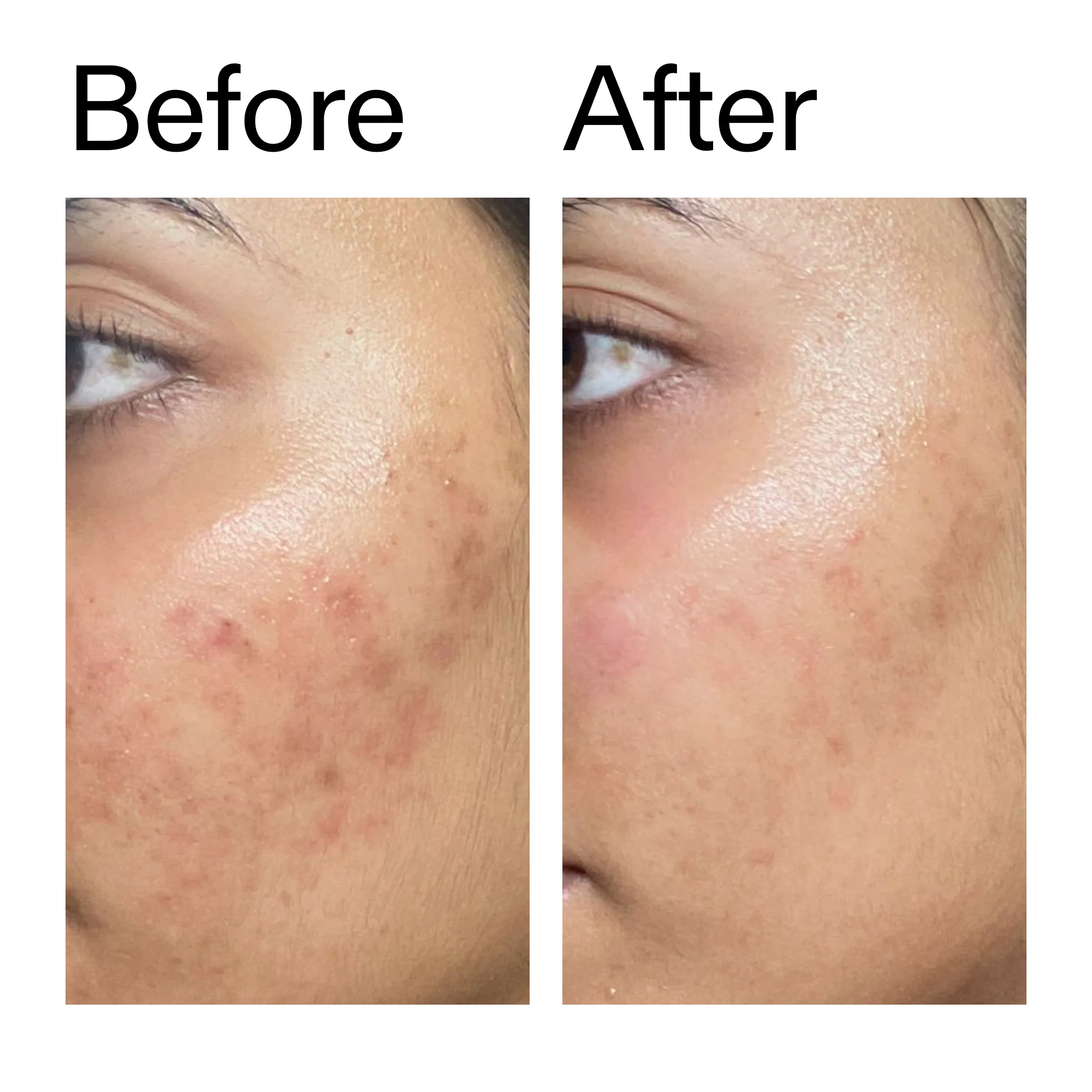 Ectoin Hydro-Barrier Serum - Image 10