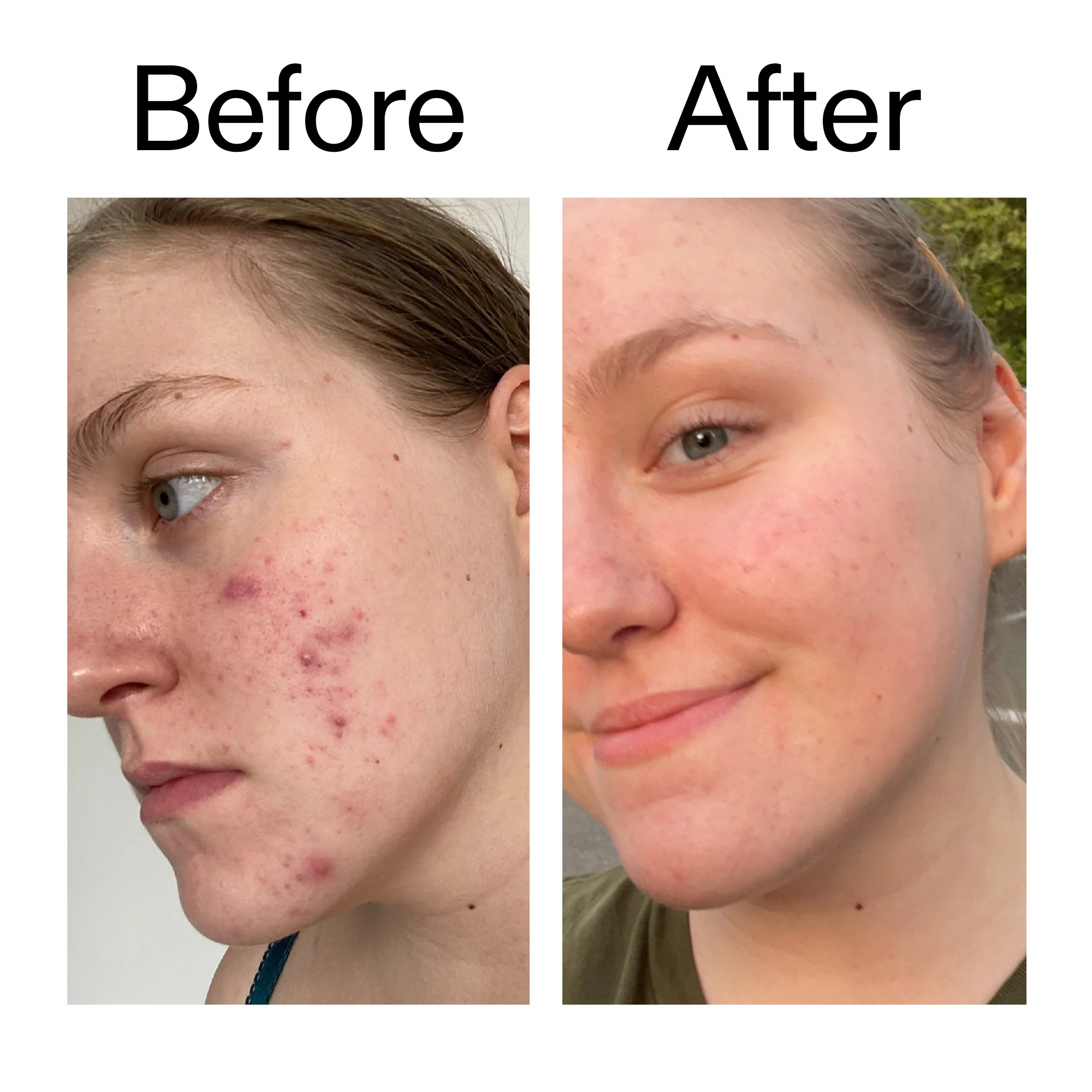 Glycolic Acid Toner - Image 8