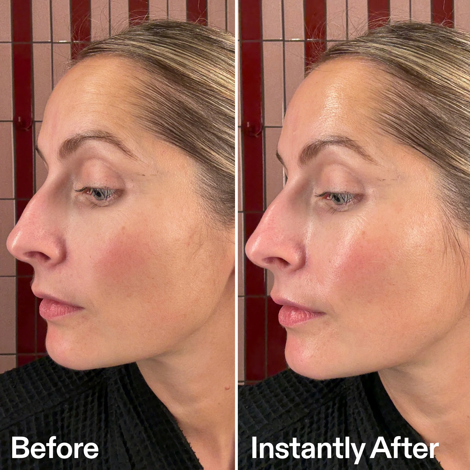 PDRN Serum - Image 9