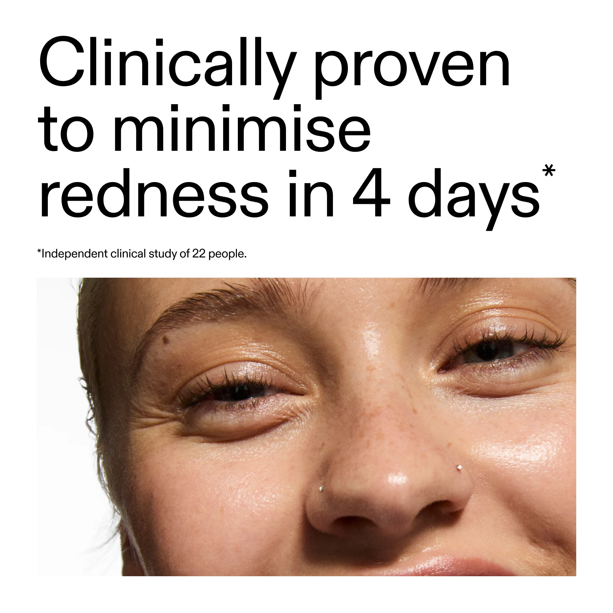 10% Azelaic Acid Serum for Redness Relief - Image 5