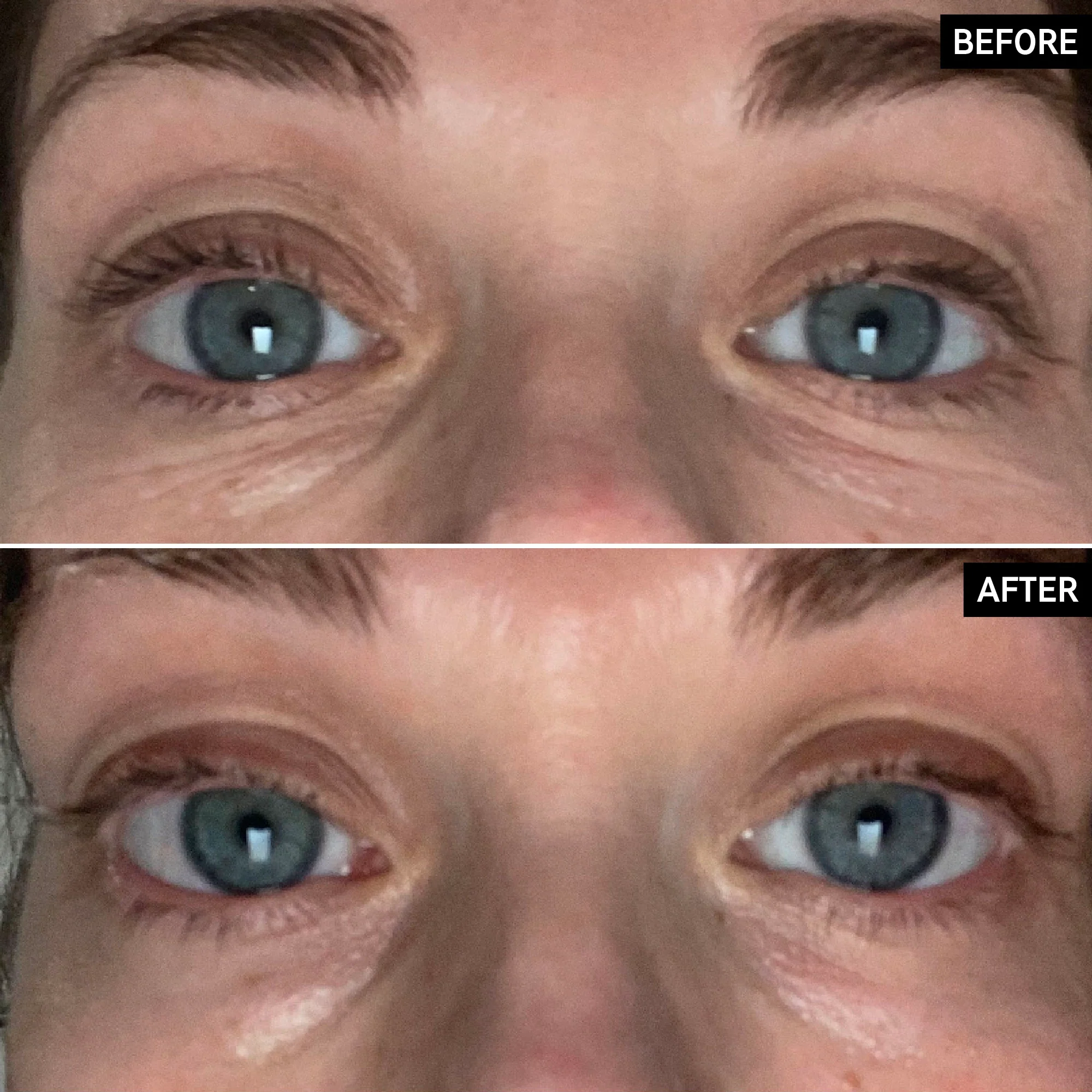Retinol Eye Cream - Image 10