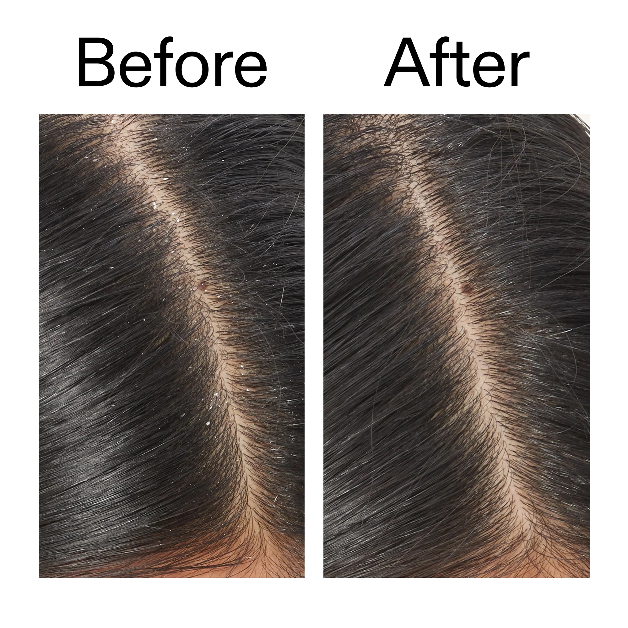 Salicylic Acid Exfoliating Scalp Treatment - Image 9