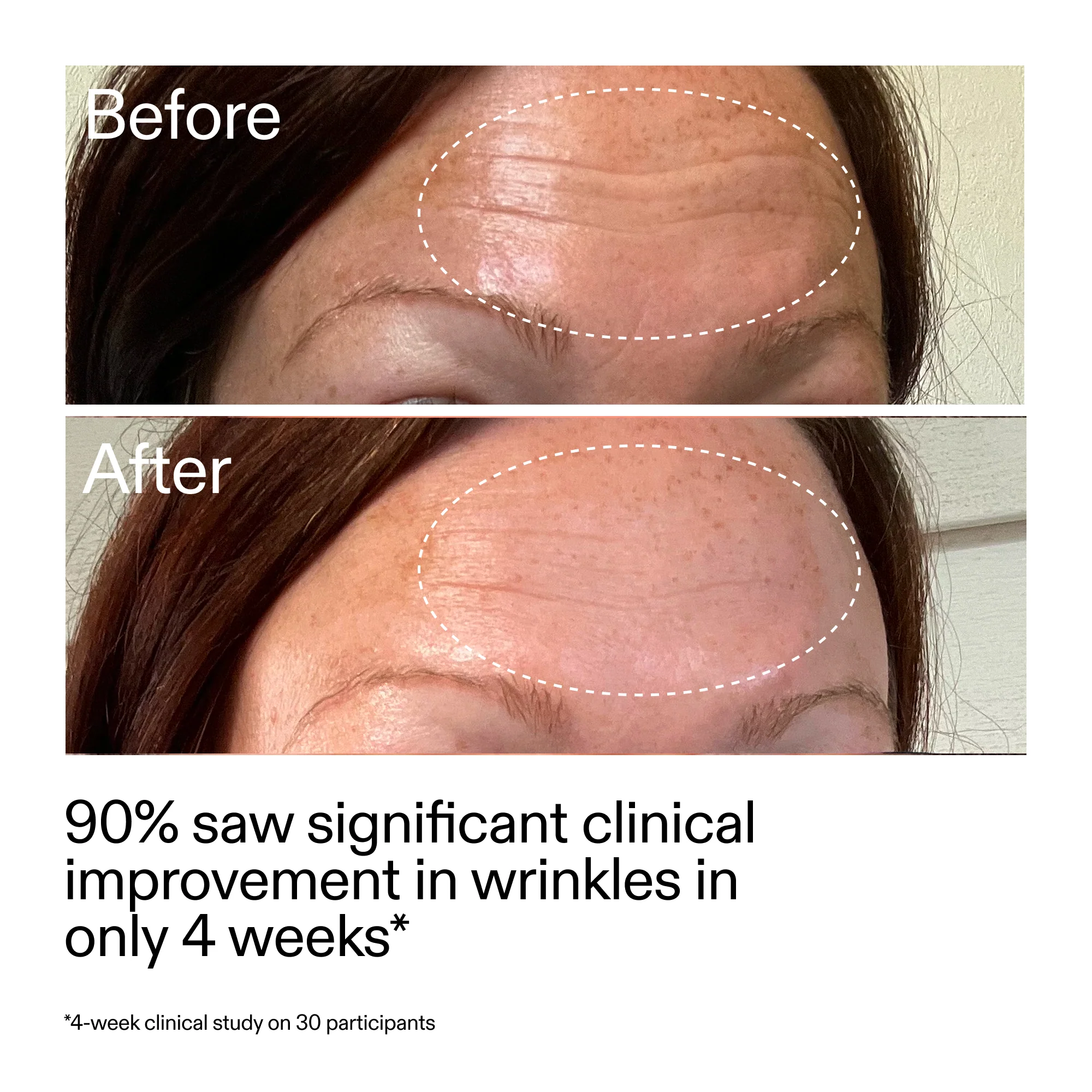 Starter Retinol Serum - Image 10