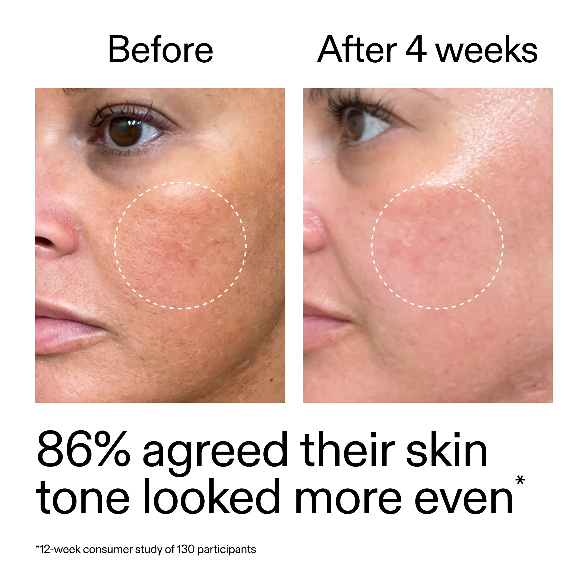 Starter Retinol Serum - Image 11