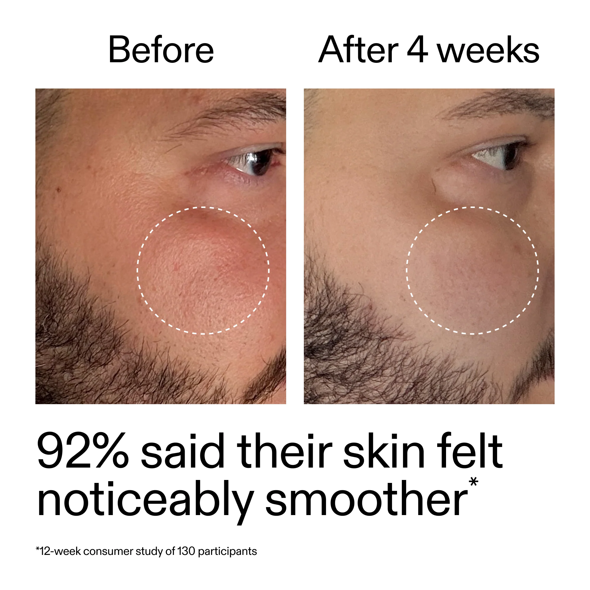 Starter Retinol Serum Duo - Image 12