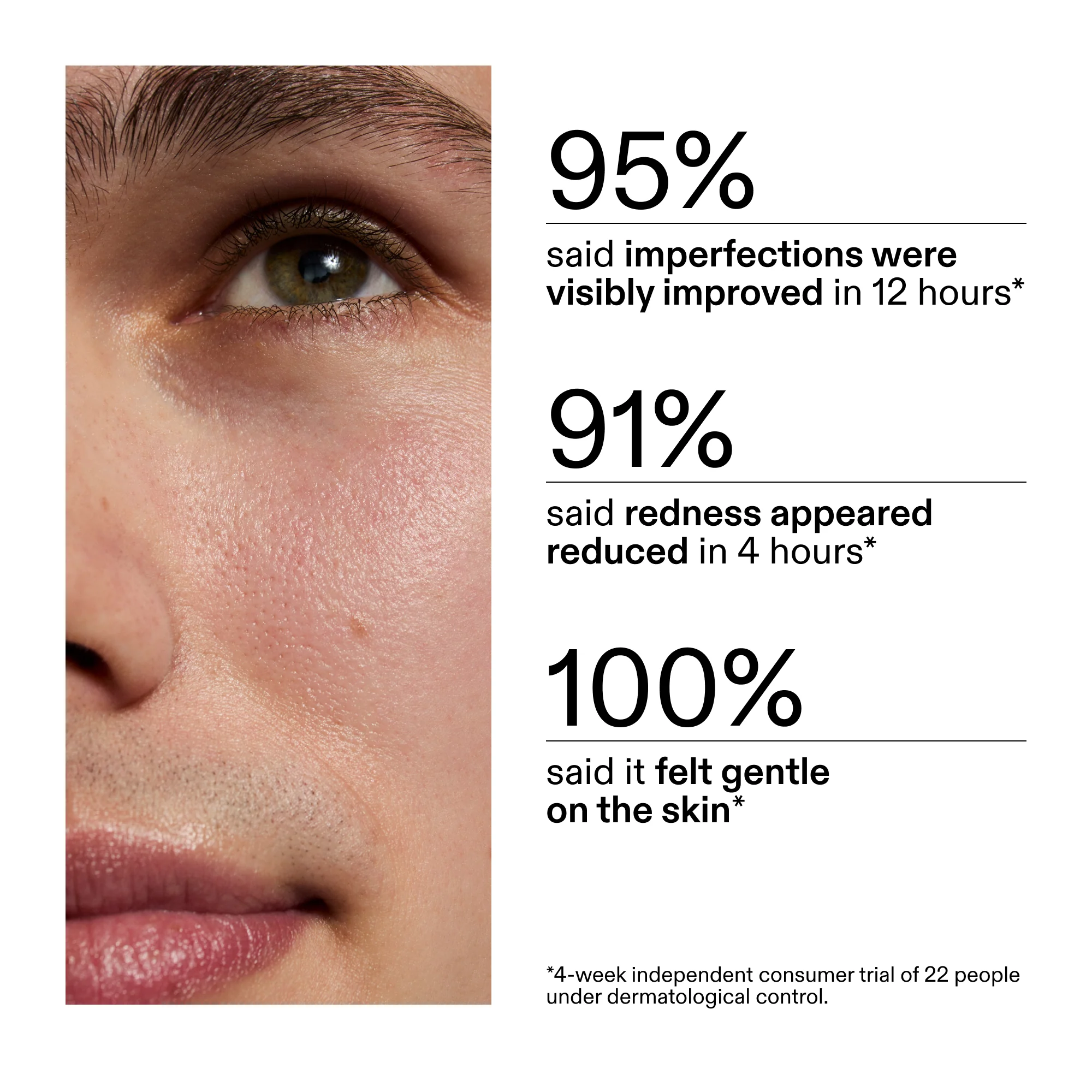 Succinic Acid Acne Treatment - Image 7