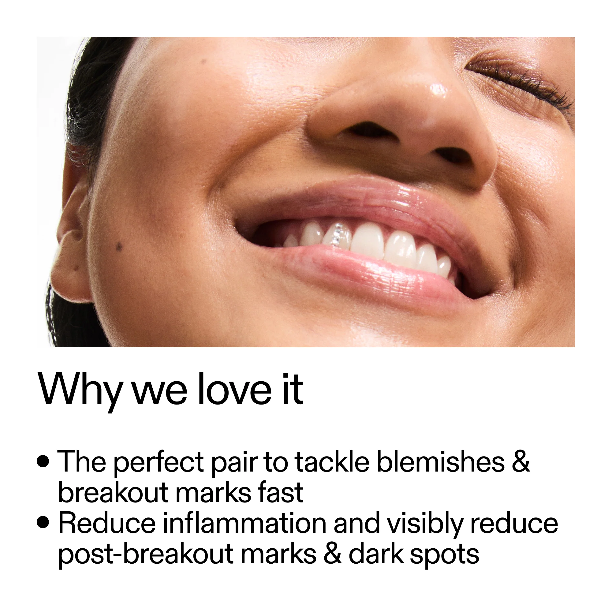 Targeted Blemish Duo - Image 4