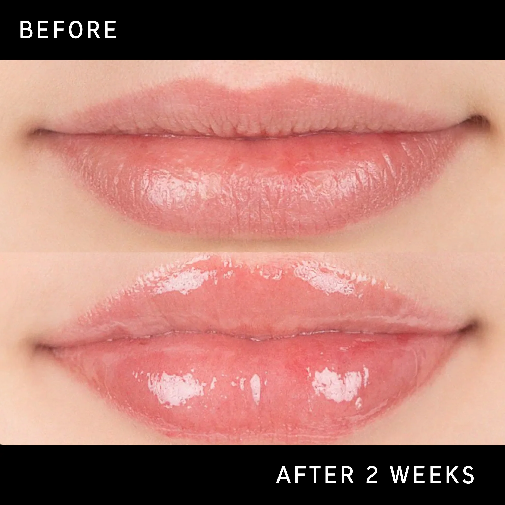 Lip Plumping Duo - Image 12