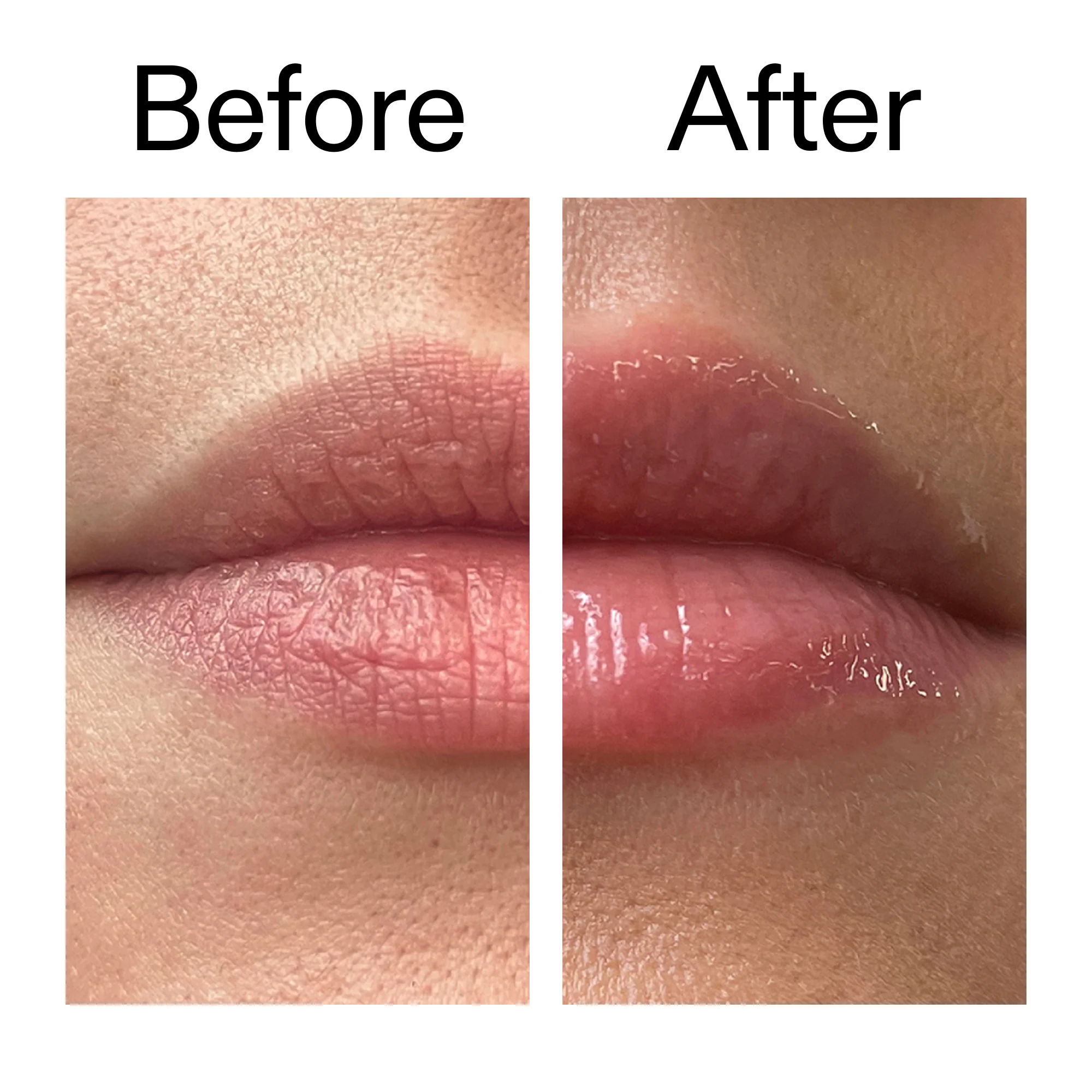 Lip Plumping Duo - Image 9