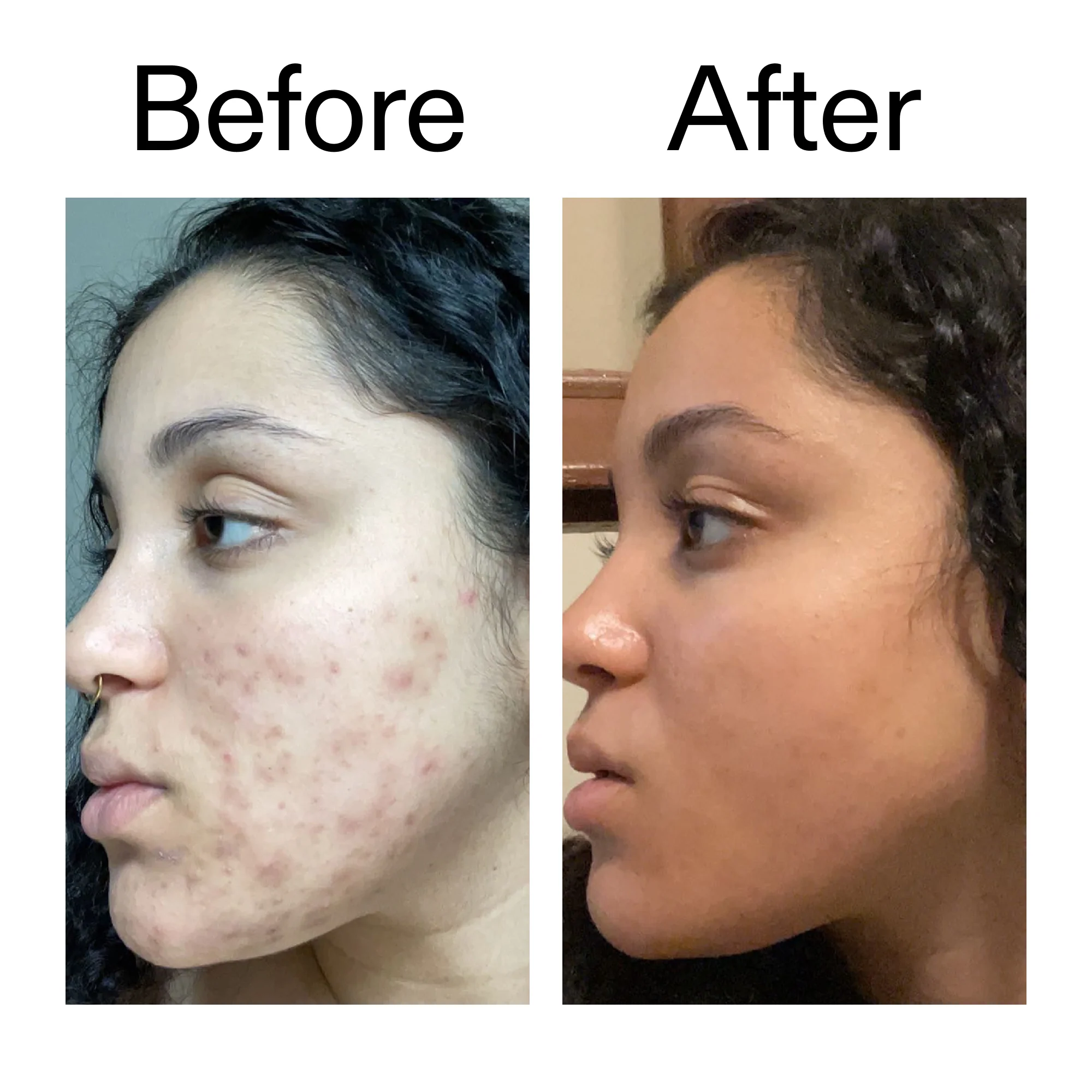 Tranexamic Acid Serum - Image 8