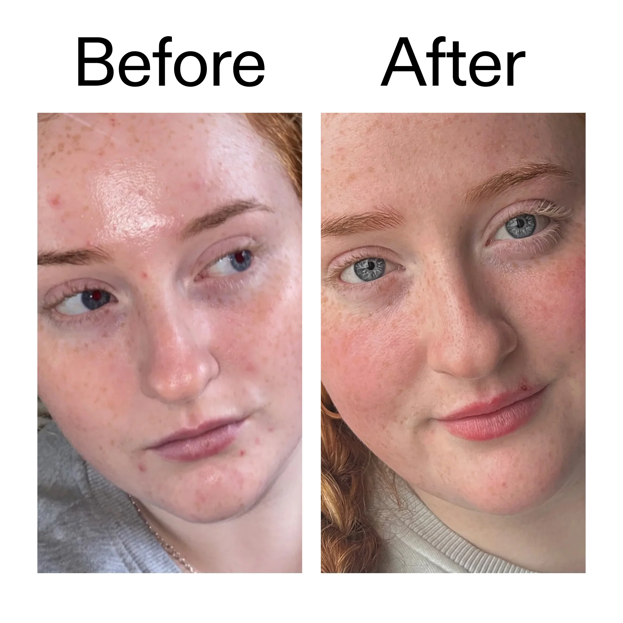 Vitamin B, C and E Moisturizer - Image 8